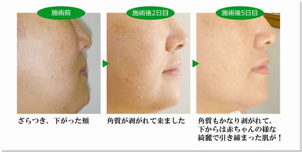 ビフォーアフター